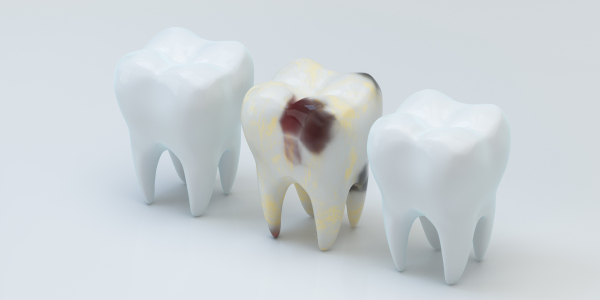 Dépistage en Orthodontie